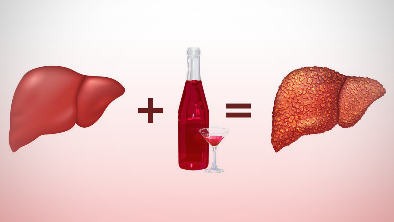 cirroz pecheni i alcohol